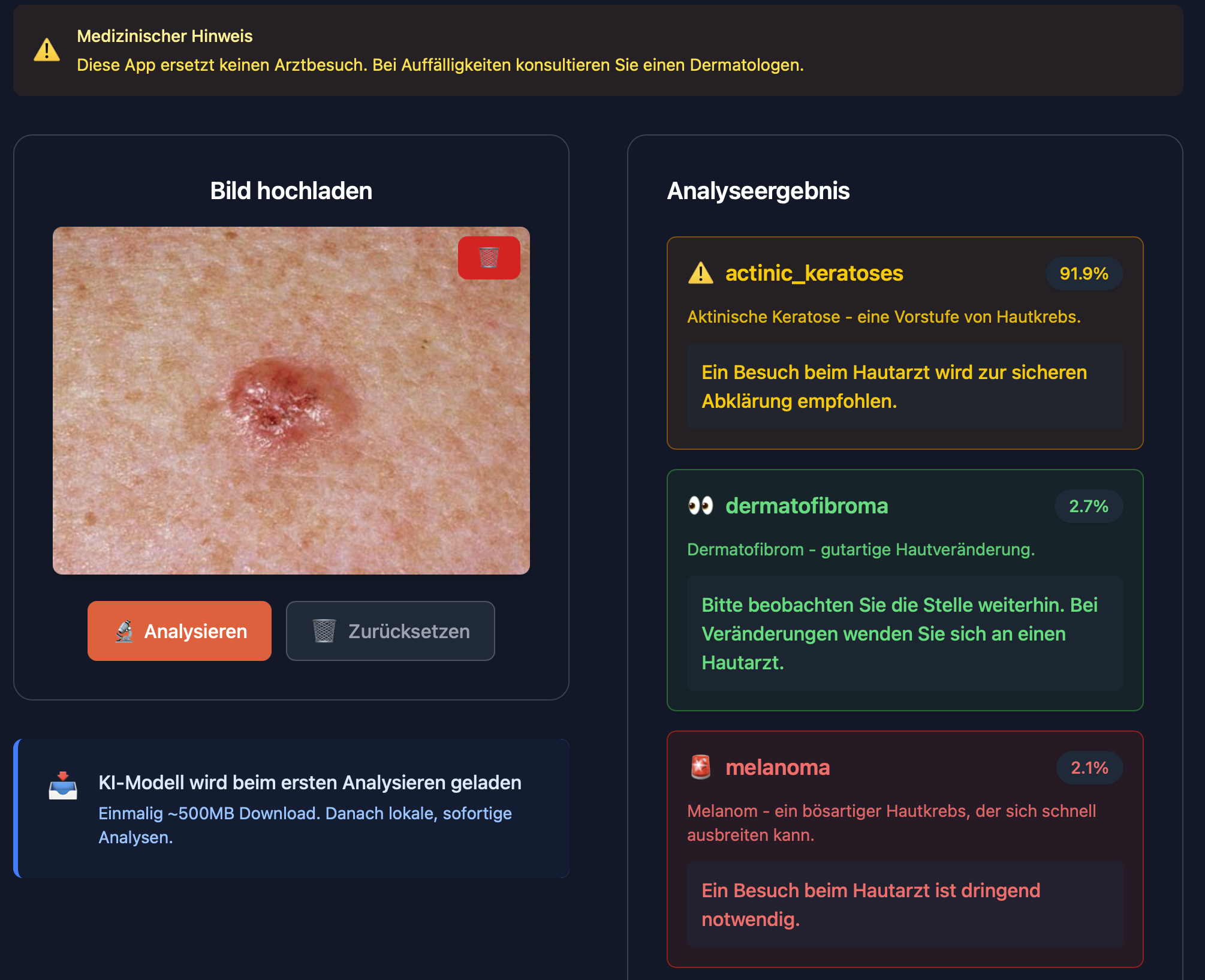 Klassifikation von Hautläsionen mit Vision Transformern